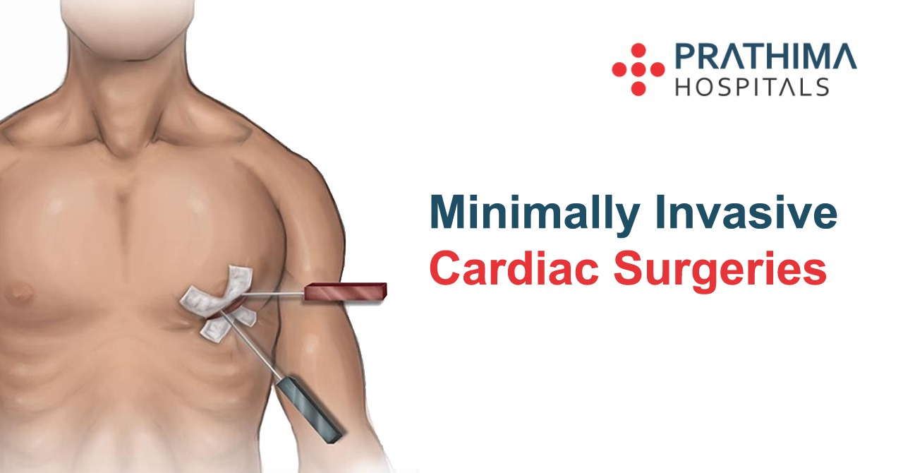 minimally invasive cardiac surgery