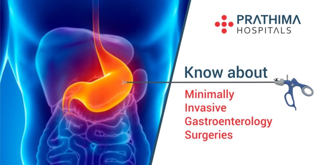 gastroenterology surgeries at prathima hospitals - best hospital in hyderabad