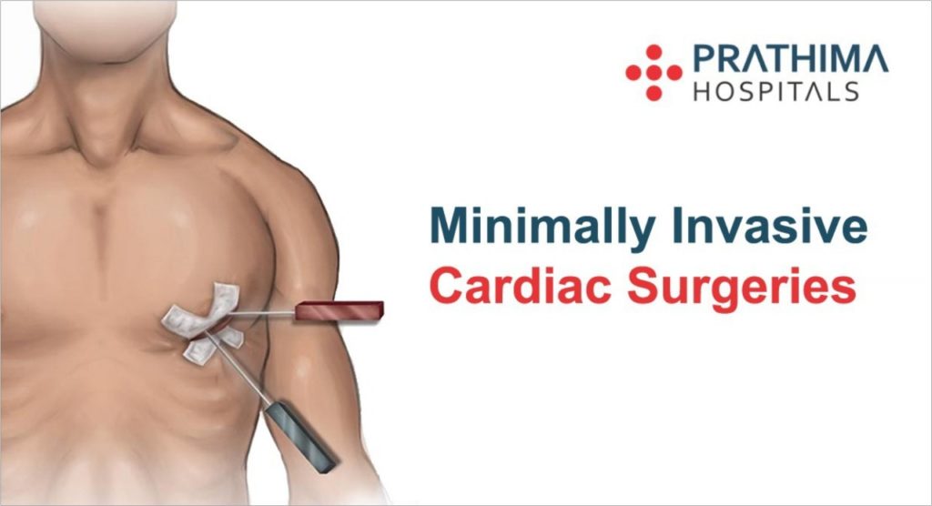 minimally invasive cardiac surgery at prathima hospitals