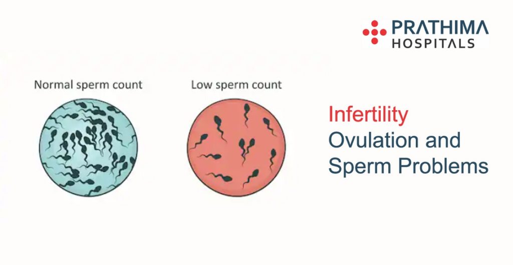 infertility ovulation