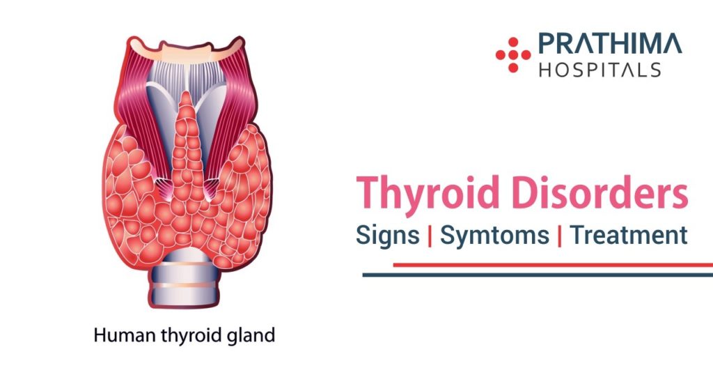 thyroid-disorders