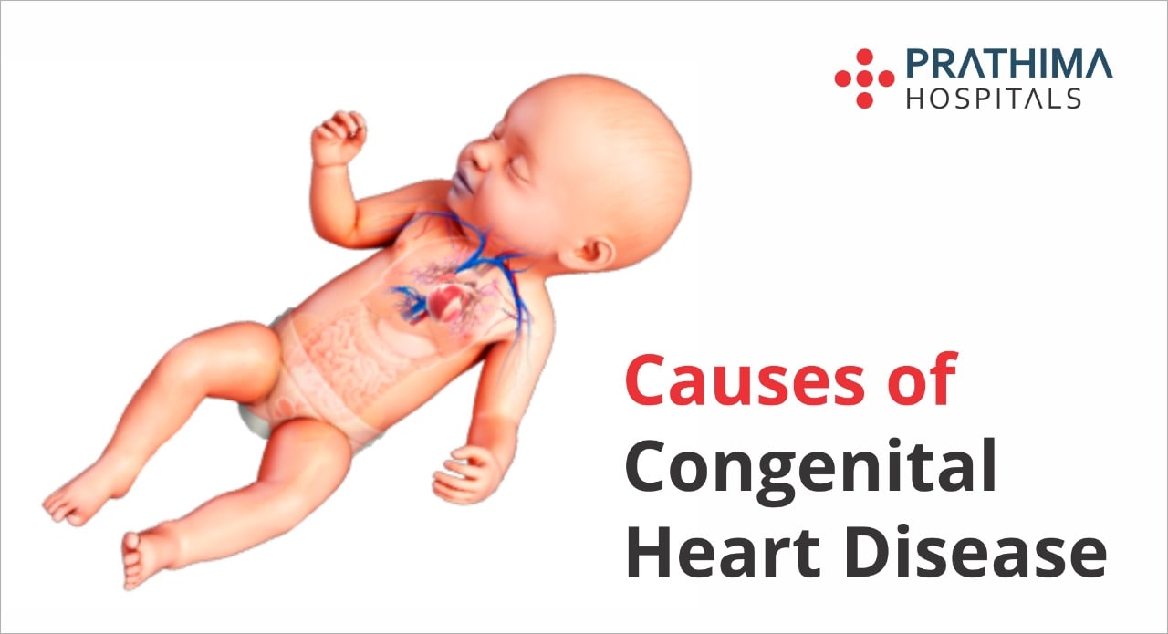 causes of congenital heart disease