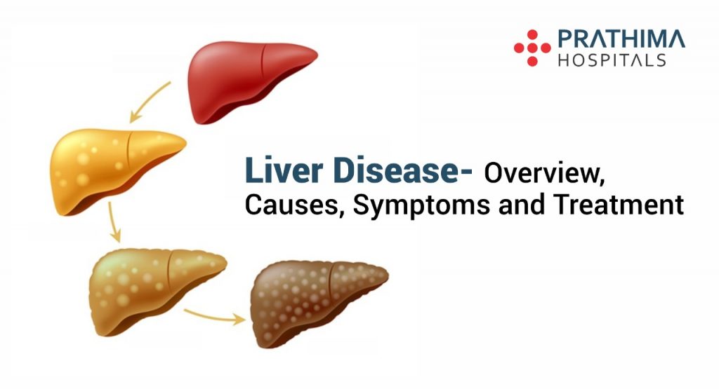 liver disease- symptoms, causes and treatment