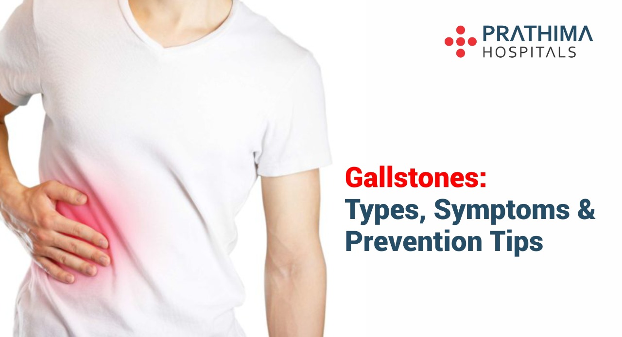 gallstones- symptoms, types and prevention tips