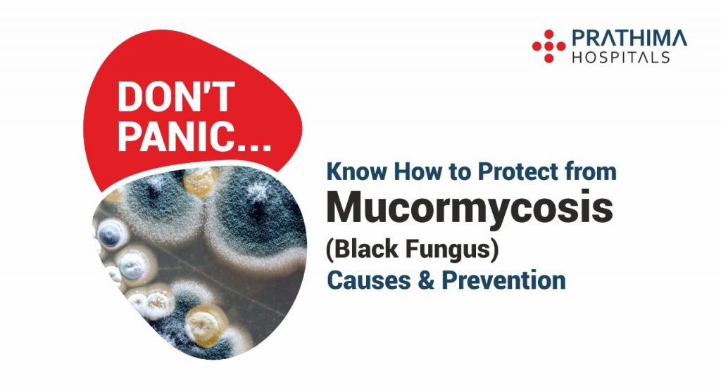 mucormycosis- causes, symptoms, treatment