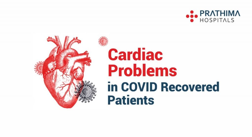 Cardiac problems in covid recovered patients