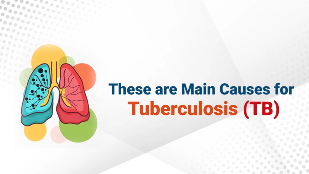 tuberculosis