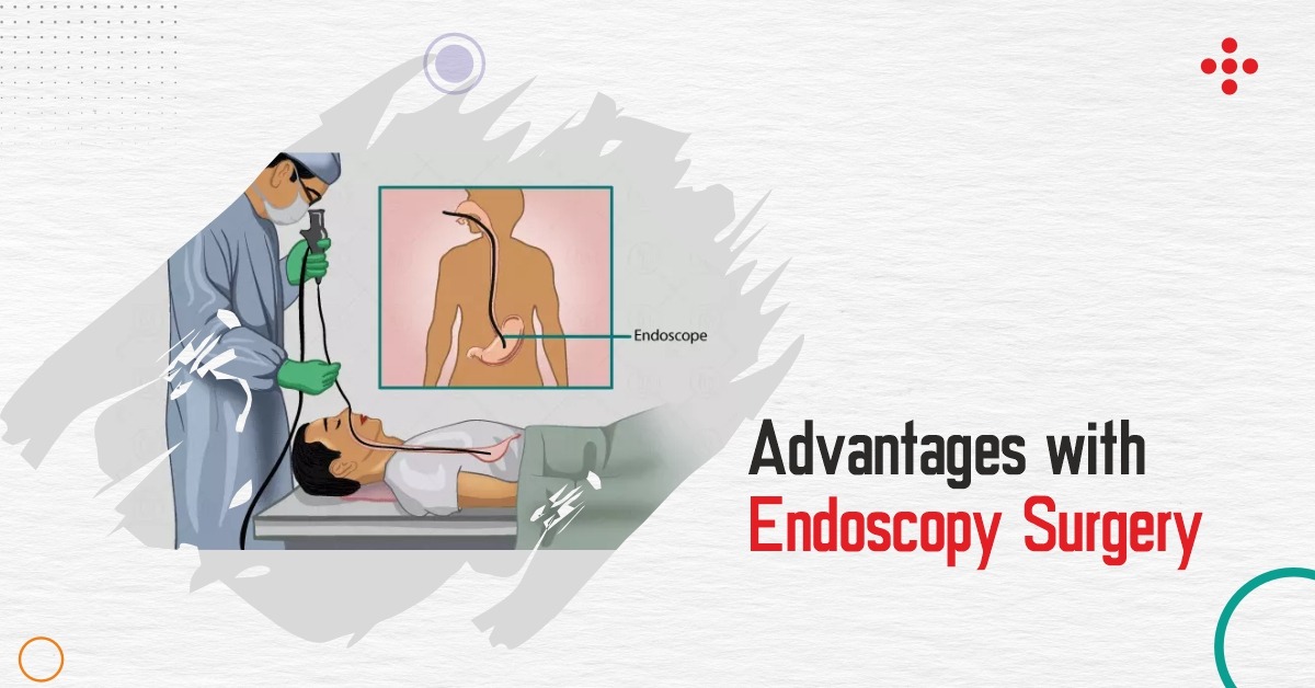 Benefits of Endoscopy Surgery