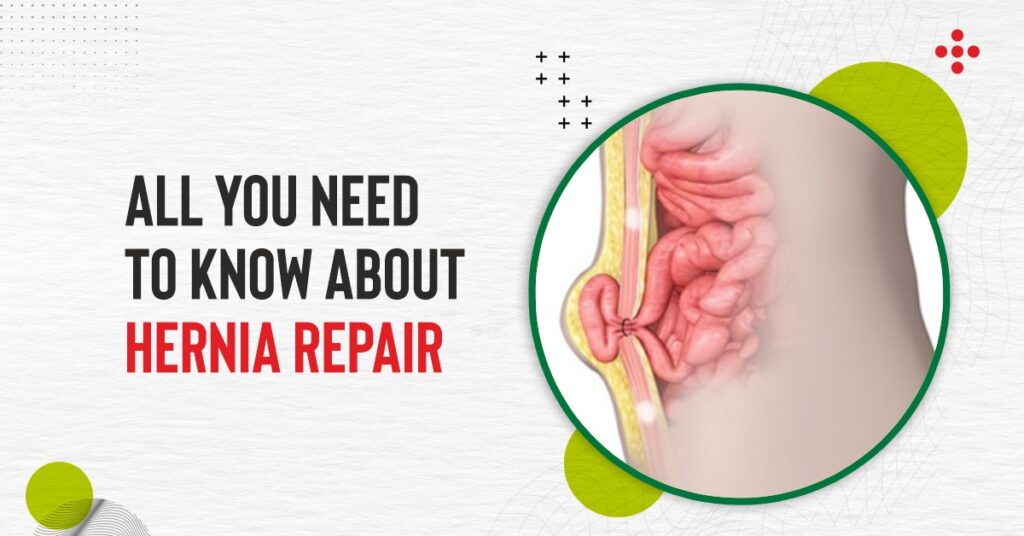 All you need to know about Hernia