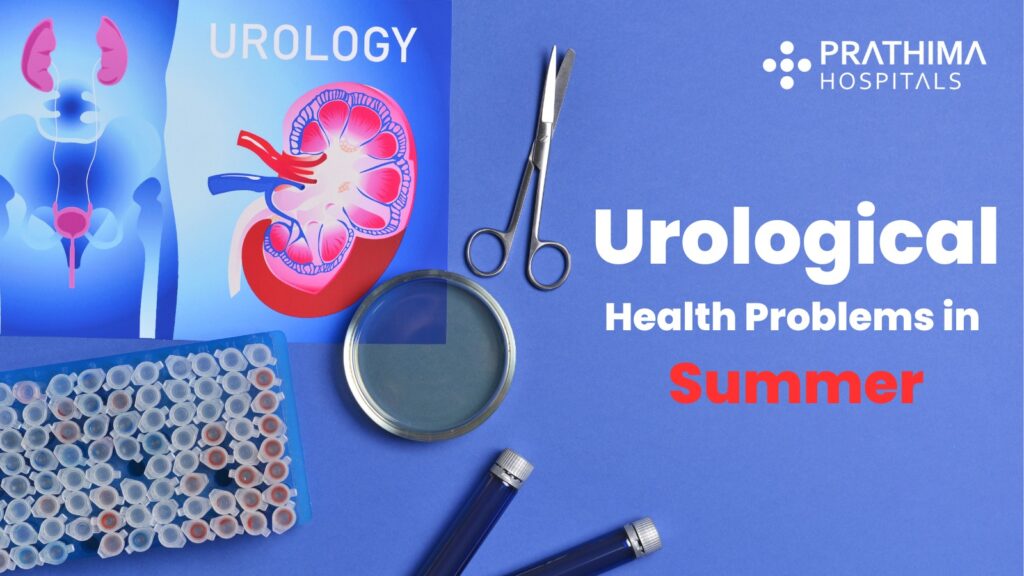 Urological Health problems in summer