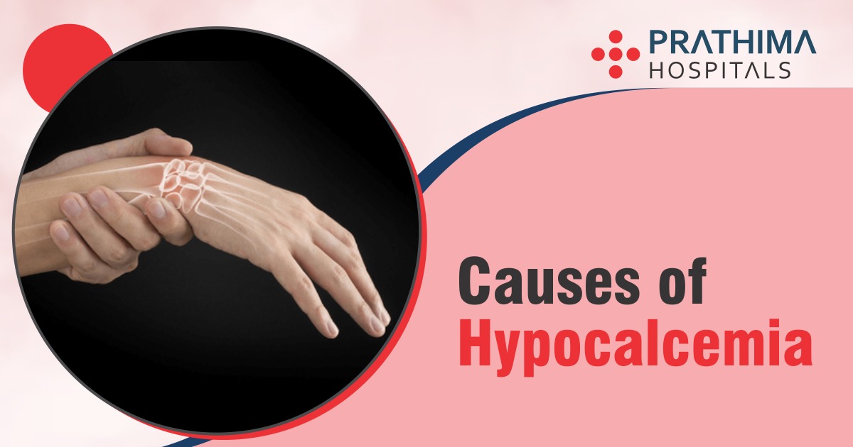 Causes and Symptoms of Hypocalcemia