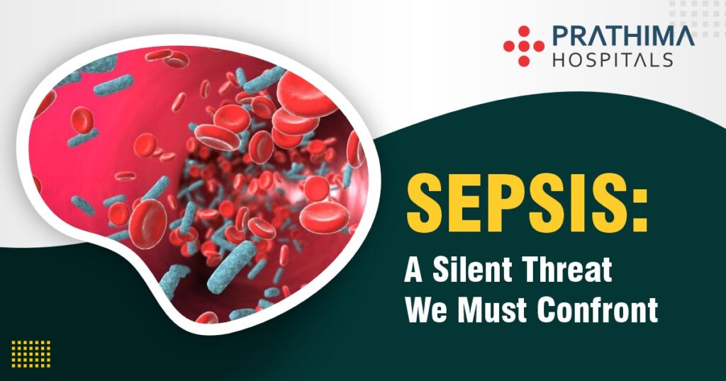 Symptoms and Causes of Sepsis