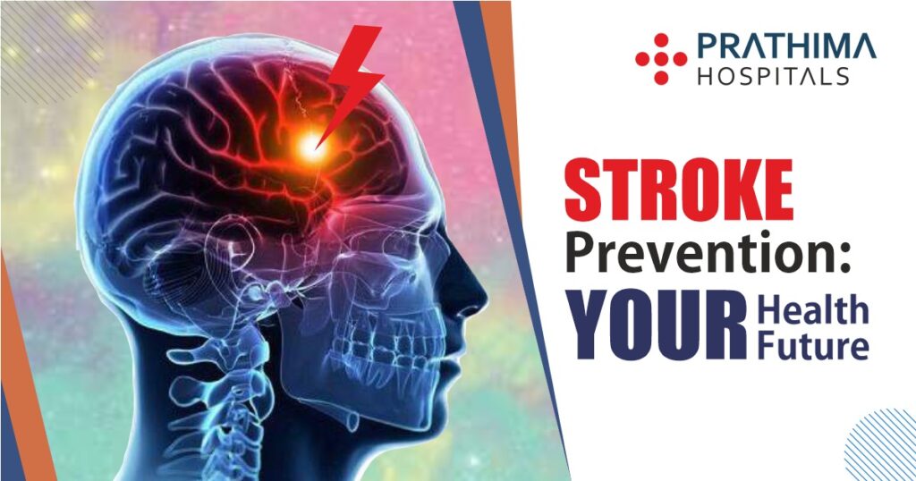 World Stroke Day 2023