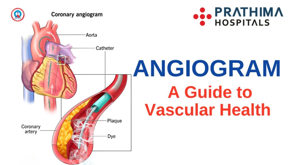 Understanding Angiograms | Best Cardiology Hospital in Hyderabad | Best Cardiologist in Kachiguda | Best Cardiologist in Kukatpally