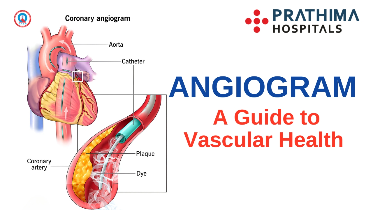 Understanding Angiograms | Best Cardiology Hospital in Hyderabad | Best Cardiologist in Kachiguda | Best Cardiologist in Kukatpally