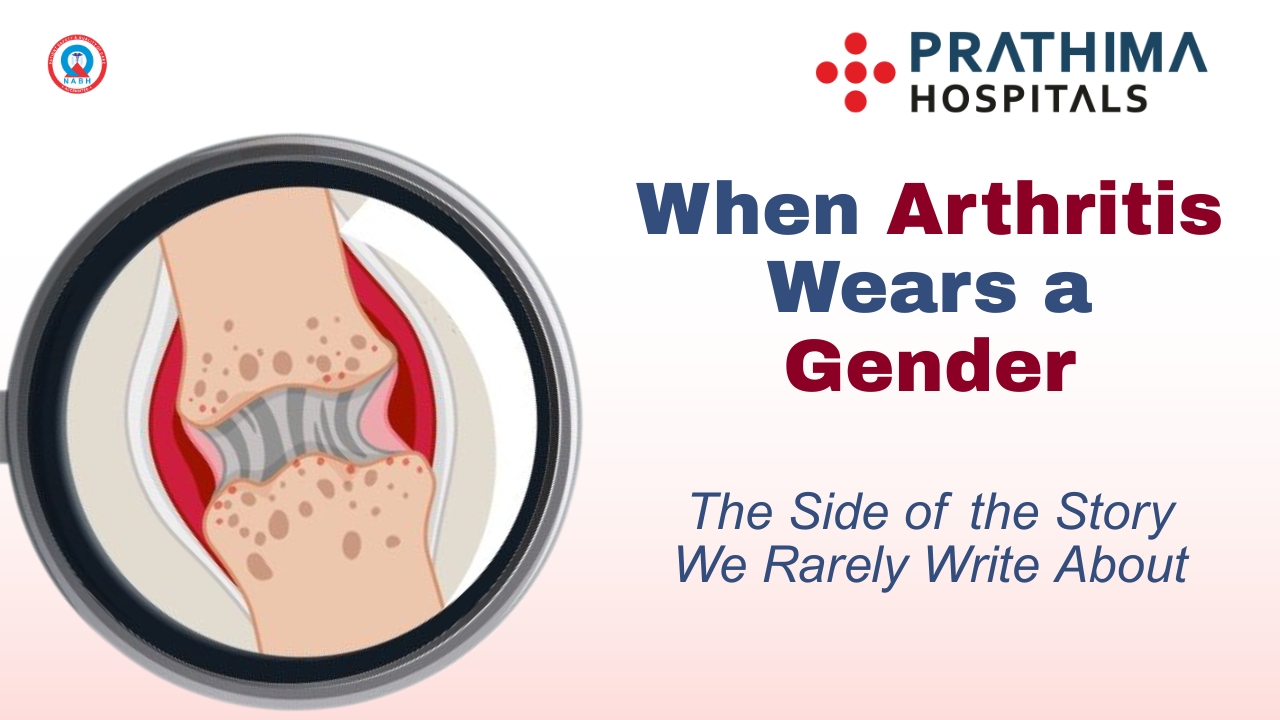 When Arthritis Wears a Gender