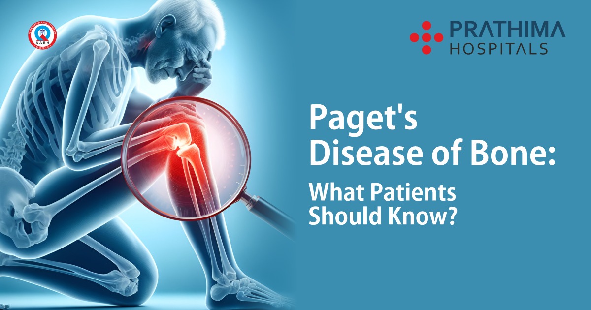 Paget’s Disease of Bone