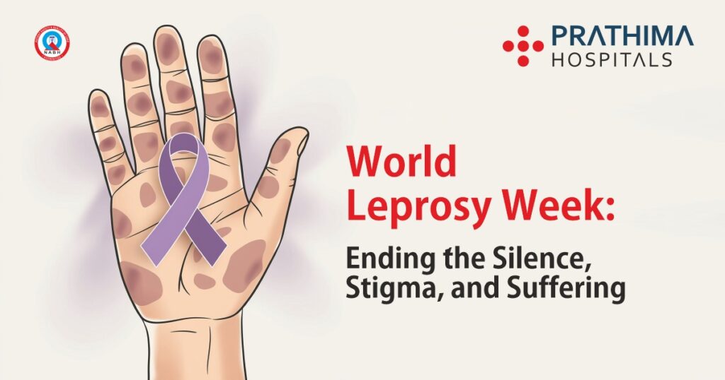 World Leprosy Week