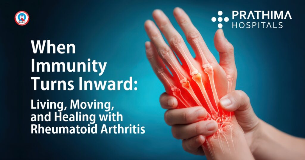Rheumatoid Arthritis Symptoms Treatment